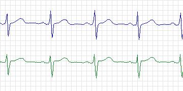 n41c thumbnail