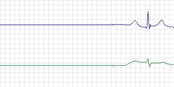 13585_06 thumbnail