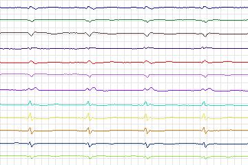s0014lre-patient001 thumbnail