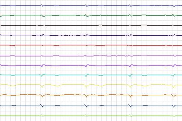 s0015lre-patient002 thumbnail