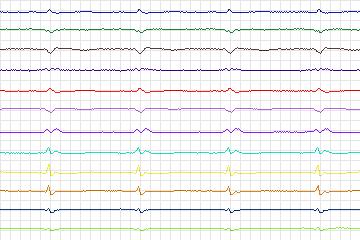 s0016lre-patient001 thumbnail