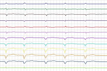 s0018cre-patient113 thumbnail
