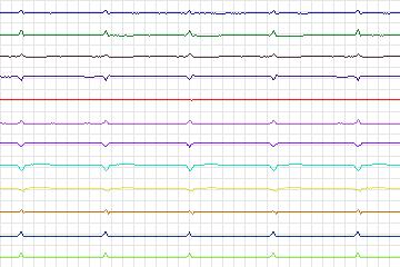 s0021bre-patient005 thumbnail