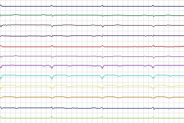 s0029lre-patient007 thumbnail