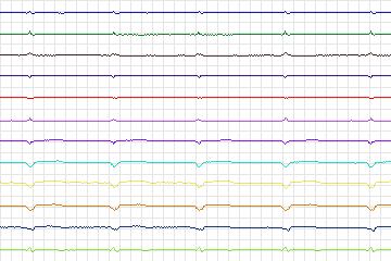 s0031lre-patient005 thumbnail
