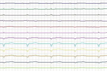 s0036lre-patient010 thumbnail