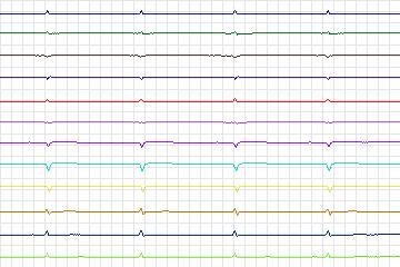 s0045lre-patient013 thumbnail