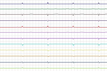 s0046lre-patient014 thumbnail