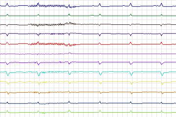s0047lre-patient015 thumbnail