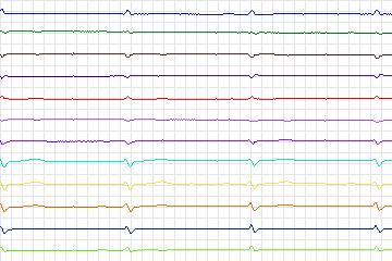 s0050lre-patient012 thumbnail