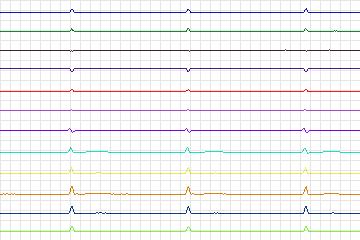 s0052lre-patient016 thumbnail