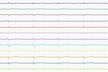 s0054lre-patient018 thumbnail