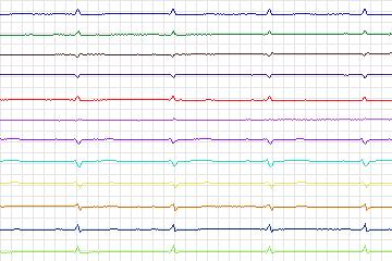 s0057lre-patient015 thumbnail
