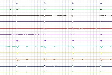 s0071lre-patient014 thumbnail