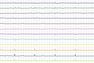 s0073lre-patient021 thumbnail