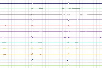 s0076lre-patient016 thumbnail