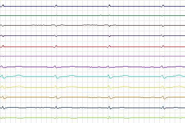 s0082lre-patient018 thumbnail