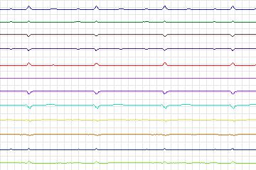 s0088lre-patient026 thumbnail