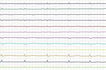 s0097lre-patient021 thumbnail