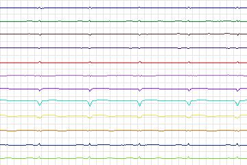 s0102lre-patient032 thumbnail