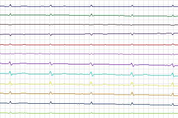s0104lre-patient031 thumbnail