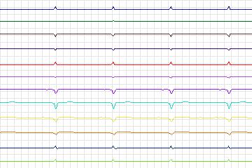 s0106lre-patient032 thumbnail