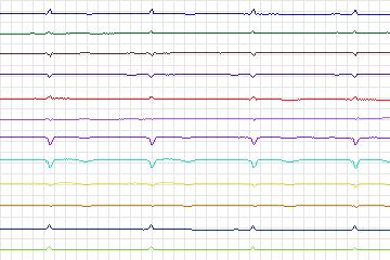 s0115lre-patient032 thumbnail