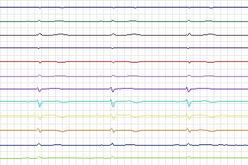 s0128lre-patient038 thumbnail