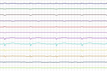 s0138lre-patient041 thumbnail