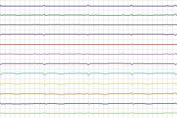 s0146lre-patient044 thumbnail