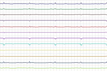 s0165lre-patient032 thumbnail