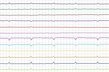 s0189_re-patient129 thumbnail