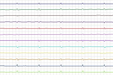 s0273lre-patient131 thumbnail