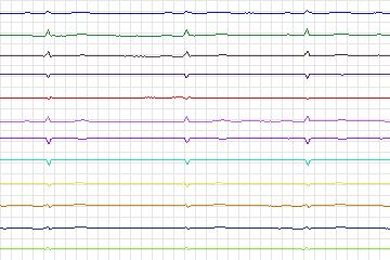 s0305lre-patient173 thumbnail