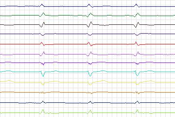 s0334lre-patient135 thumbnail