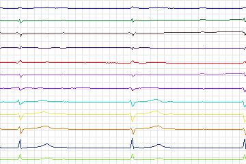 s0349lre-patient109 thumbnail