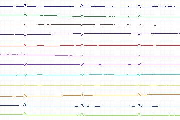 s0355lre-patient089 thumbnail