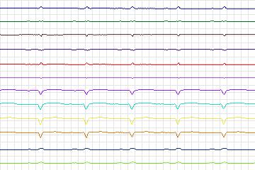 s0400lre-patient101 thumbnail