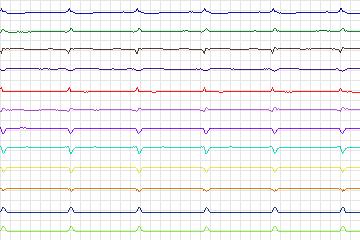 s0407lre-patient100 thumbnail