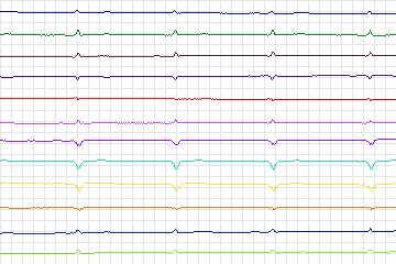 s0419lre-patient099 thumbnail